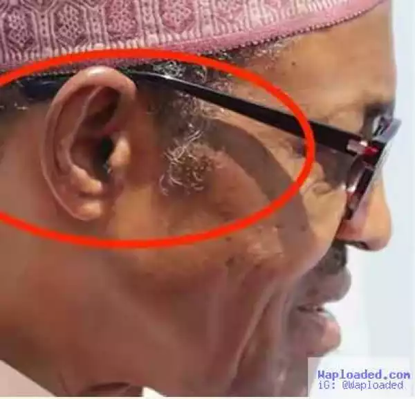 Ear Infection: More Details About Buhari